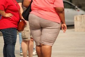 obese women